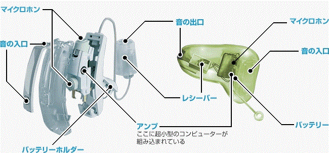 補聴器仕組み