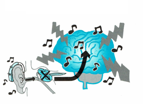 音の刺激で脳が不快に感じるの図
