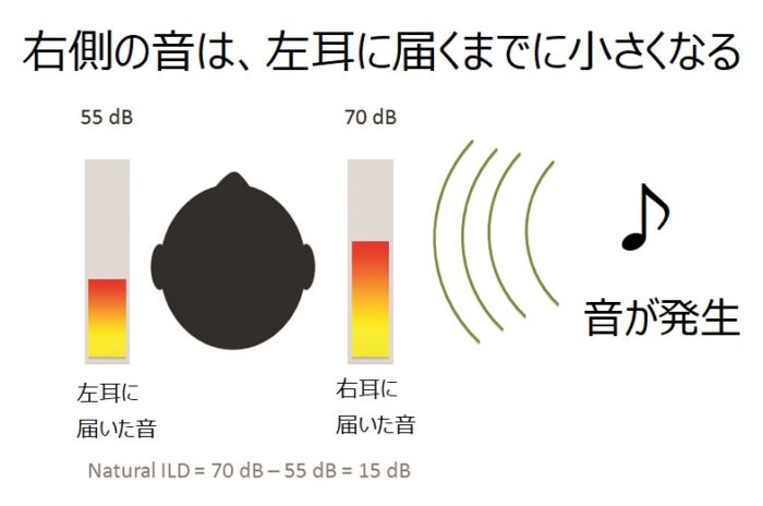 ILD