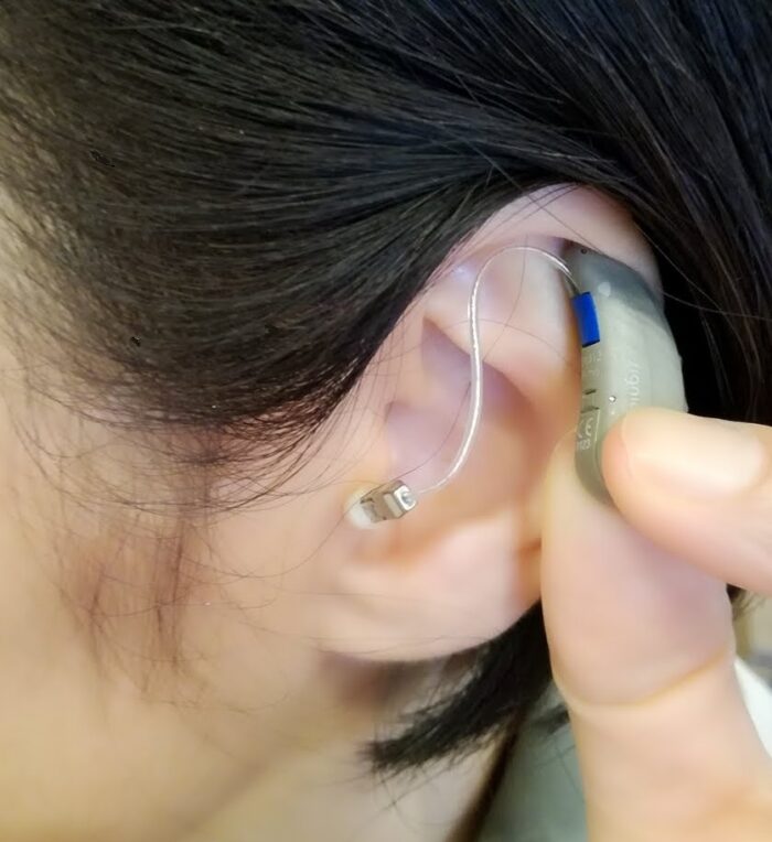 補聴器をもつ様子