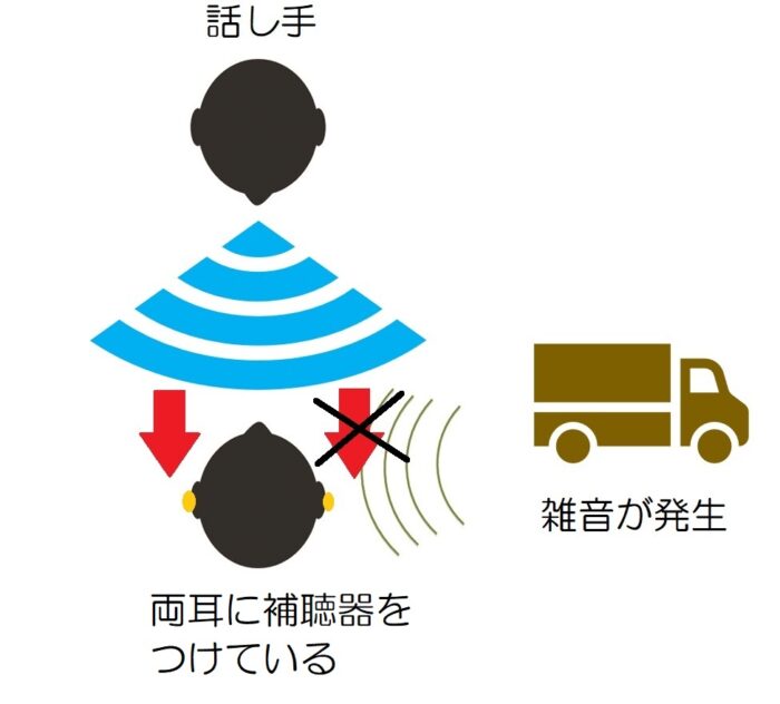 両耳とも補聴器を着けている場合の言葉の聞き取りやすさ。正面からの音(声)は、右側は雑音にかき消される。左側は、補聴器を着けていないので聞こえる。