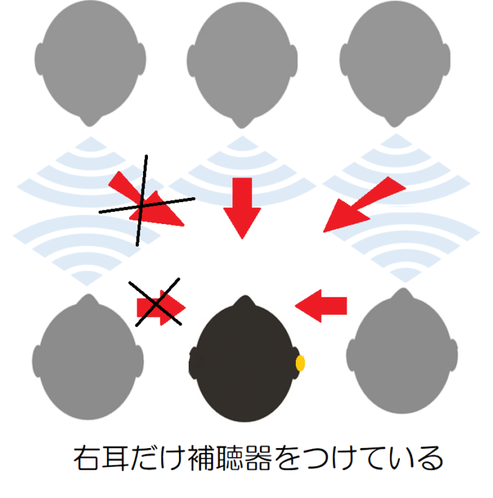 右耳だけ補聴器を着けて、複数の人と会話をしている。右耳だけ補聴器を着けている場合、右方向からの声は聞き取れる。左方向からの声は聞き取りにくい。