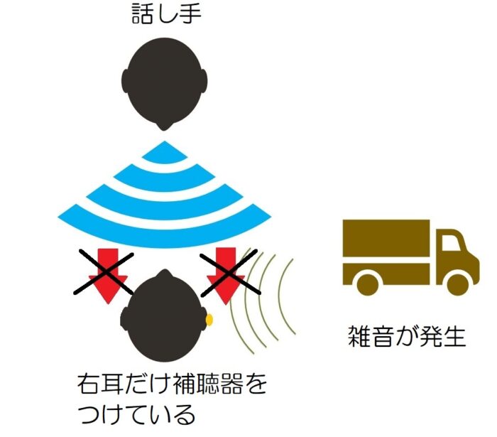 右耳だけ補聴器を着けている場合。正面からの音(声)は、右側は雑音にかき消される。左側は、補聴器を着けていないので聞こえない。