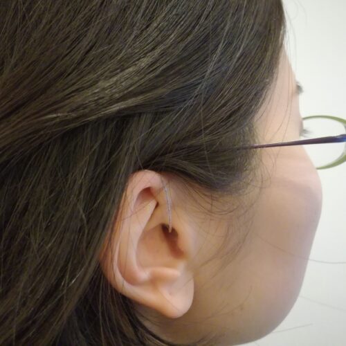 RIC補聴器を装用した様子