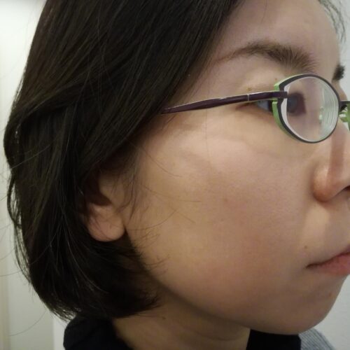 RIC補聴器を装用した様子