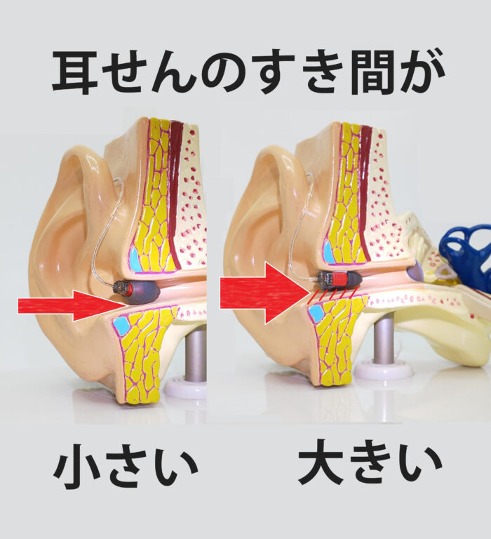 耳の穴への入れ方の確認、耳せんの変更
