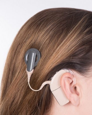 人工内耳をつけた様子