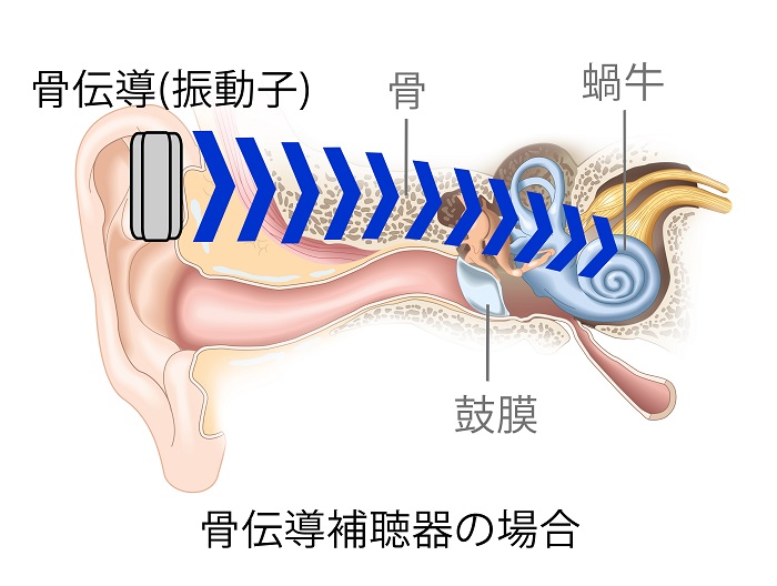 骨の振動が分かる画像