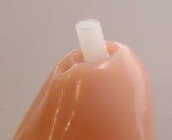延長チューブ