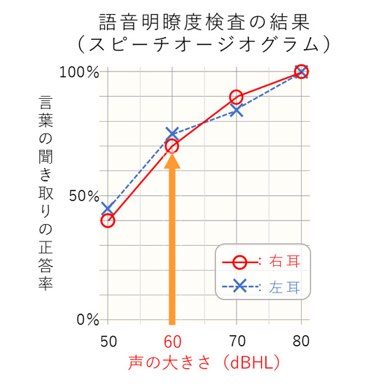 語音明瞭度検査の結果と読み方