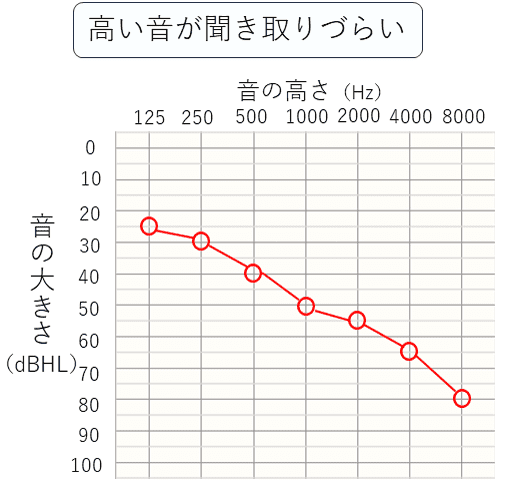高い音が聞き取りづらい人のデータ