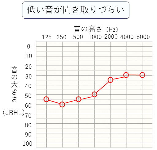 低い音が聞き取りづらい人のデータ