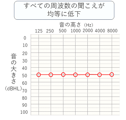 全ての周波数の聞こえが均一に低下