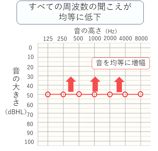 すべての周波数の聞こえが均等に低下