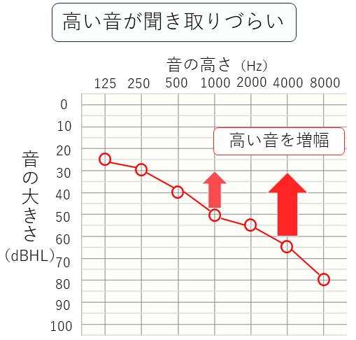高い音が聞き取りづらい